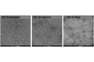 TEM of amyloid beta 1-42 monomers (ABIN7272125, ABIN7272126 and ABIN7272127, left), oligomers (ABIN7272125, ABIN7272126 and ABIN7272127, middle) and fibrils (ABIN7272125, ABIN7272126 and ABIN7272127, right).
