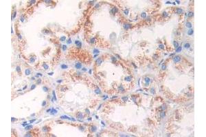 DAB staining on IHC-P;;Samples: Human Kidney Tissue (GLUD1 anticorps  (AA 334-556))