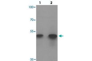 Western blot analysis of ACSL1 in human lung tissue with ACSL1 polyclonal antibody  at (1) 1 and (2) 2 ug/mL. (ACSL1 anticorps  (Internal Region))