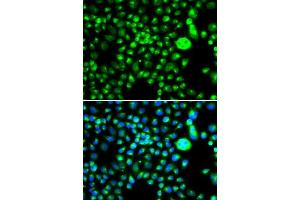 Immunofluorescence analysis of MCF-7 cells using SMCHD1 antibody. (SMCHD1 anticorps  (AA 1756-2005))