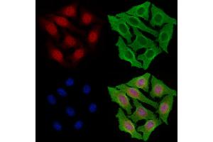 ABIN7094485 and ABIN7098534 staining Hela cells by IF/ICC. (KDM6A anticorps  (Internal Region))