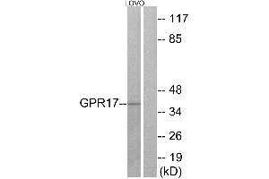 Western blot analysis of extracts from LOVO cells, using GPR17 antibody. (GPR17 anticorps  (Internal Region))