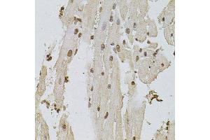 Immunohistochemistry of paraffin-embedded mouse heart using EGFR antibody. (EGFR anticorps  (AA 1021-1210))