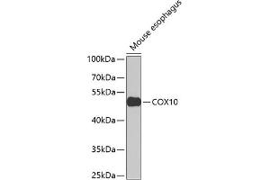 Western blot analysis of extracts of mouse esophagus, using COX10 Antibody (ABIN6133361, ABIN6138907, ABIN6138908 and ABIN6223449) at 1:1000 dilution. (COX10 anticorps  (AA 1-160))