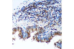 Immunohistochemistry of paraffin-embedded Rat lung using FBXO21 Rabbit pAb (ABIN7267085) at dilution of 1:100 (40x lens). (FBXO21 anticorps  (AA 440-621))