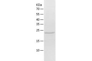 Western Blotting (WB) image for Desmoplakin (DSP) (AA 78-300) protein (His tag) (ABIN7285449) (Desmoplakin Protein (DSP) (AA 78-300) (His tag))