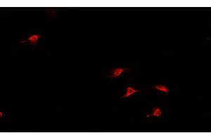 ABIN6266944 staining U-2 OS cells by IF/ICC. (HAND1 anticorps  (Internal Region))