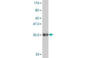 Western Blot detection against Immunogen (35. (Deoxyguanosine Kinase anticorps  (AA 1-89))