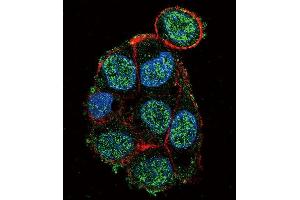 Immunofluorescence (IF) image for anti-Von Hippel-Lindau Tumor Suppressor, E3 Ubiquitin Protein Ligase (VHL) antibody (ABIN2905637)