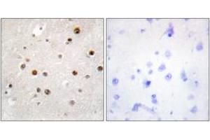 Immunohistochemistry analysis of paraffin-embedded human brain tissue, using TSN Antibody. (Translin anticorps  (AA 101-150))