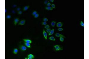 Immunofluorescent analysis of PC-3 cells using ABIN7173067 at dilution of 1:100 and Alexa Fluor 488-congugated AffiniPure Goat Anti-Rabbit IgG(H+L) (TMEM14A anticorps  (AA 45-78))