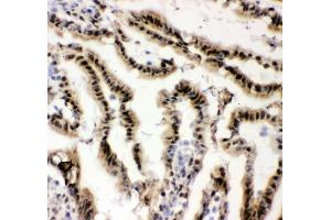 IHC analysis of EWSR1 using anti-EWSR1 antibody (ABIN3043825). (EWSR1 anticorps  (Middle Region))