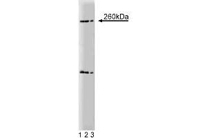 Western blot analysis of Nestin on a rat (E17) cerebrum lysate. (Nestin anticorps  (AA 402-604))