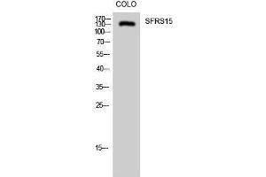 Western Blotting (WB) image for anti-SR-Related CTD-Associated Factor 4 (SCAF4) (Internal Region) antibody (ABIN3177385) (SCAF4 anticorps  (Internal Region))