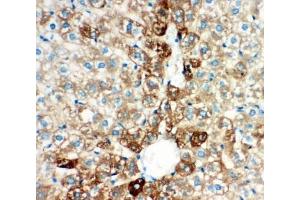 IHC testing of FFPE rat liver tissue with CYP2E1 antibody at 1ug/ml.