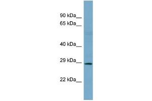 Host:  Rabbit  Target Name:  SNAI1  Sample Type:  NCI-H226 Whole cell lysates  Antibody Dilution:  1. (SNAIL anticorps  (N-Term))
