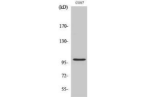Western Blotting (WB) image for anti-AP2 associated kinase 1 (AAK1) (Internal Region) antibody (ABIN3173608) (AAK1 anticorps  (Internal Region))