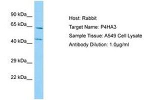 Image no. 1 for anti-Prolyl 4-Hydroxylase, alpha Polypeptide III (P4HA3) (AA 77-126) antibody (ABIN6750125) (P4HA3 anticorps  (AA 77-126))