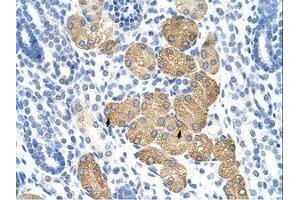 Image no. 1 for anti-Deleted In Azoospermia 4 (DAZ4) (N-Term) antibody (ABIN6736264)