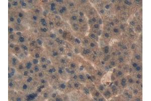 Detection of aHSP in Rat Liver Tissue using Polyclonal Antibody to Alpha-Hemoglobin Stabilizing Protein (aHSP) (aHSP anticorps  (AA 2-102))