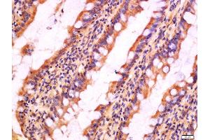 Formalin-fixed and paraffin embedded mouse intestine labeled with Anti-Cryopyrin Polyclonal Antibody, Unconjugated  at 1:200 followed by conjugation to the secondary antibody and DAB staining.