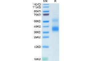 Human Rankl on Tris-Bis PAGE under reduced condition.