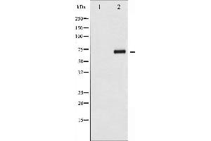 Western blot analysis of CDC25A phosphorylation expression in UV treated 293 whole cell lysates,The lane on the left is treated with the antigen-specific peptide.