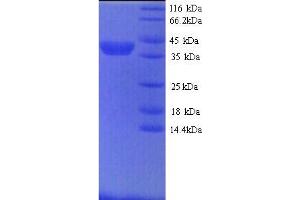 SDS-PAGE (SDS) image for Matrix Metallopeptidase 9 (Gelatinase B, 92kDa Gelatinase, 92kDa Type IV Collagenase) (MMP9) (AA 107-704) protein (His tag) (ABIN5713656)