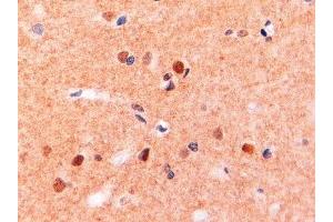 ABIN2563481 (2µg/ml) staining of paraffin embedded Human Brain. (CD11b anticorps  (Internal Region))