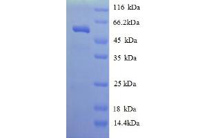 SDS-PAGE (SDS) image for Kallikrein 7 (KLK7) (AA 28-253) protein (His tag) (ABIN5709811)
