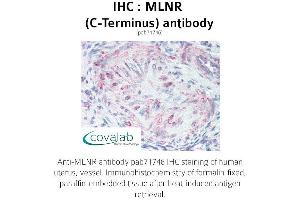Image no. 1 for anti-Motilin Receptor (MLNR) (C-Term), (Cytoplasmic Domain) antibody (ABIN1736988) (Motilin Receptor anticorps  (C-Term, Cytoplasmic Domain))