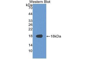 Western Blotting (WB) image for anti-Supervillin (SVIL) (AA 1385-1525) antibody (ABIN3201726) (Supervillin anticorps  (AA 1385-1525))