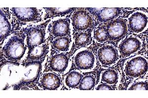 Detection of PON1 in Human Colon Tissue using Polyclonal Antibody to Paraoxonase 1 (PON1)