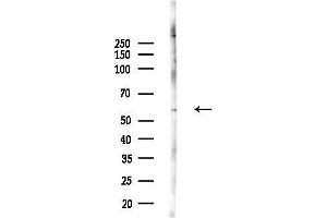 Western blot analysis of lysates from 293 cells(starvation,24h treatment), using ZNF329 Antibody at 1/1000 dilution.