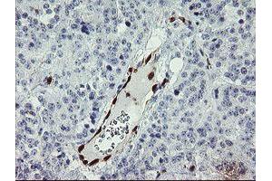 Image no. 12 for anti-GTPase, IMAP Family Member 4 (GIMAP4) antibody (ABIN1498460)