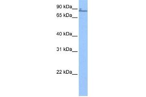 WB Suggested Anti-ZNF432 Antibody Titration:  0. (ZNF432 anticorps  (N-Term))