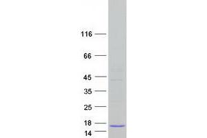 Validation with Western Blot