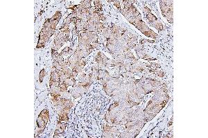 IHC analysis of PRKCD using anti-PRKCD antibody (ABIN7601631).