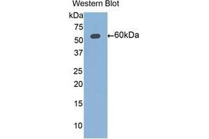 Western blot analysis of the recombinant protein. (ALDH7A1 anticorps  (AA 1-539))