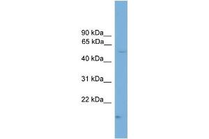 Human Jurkat; WB Suggested Anti-CDS1 Antibody Titration: 0. (CDS1 anticorps  (N-Term))