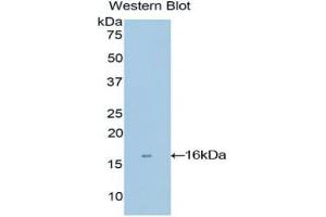 Western blot analysis of recombinant Human MGP.
