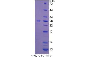 Image no. 1 for Interleukin 12 alpha (IL12A) (AA 23-215) protein (His tag) (ABIN6236555) (IL12A Protein (AA 23-215) (His tag))