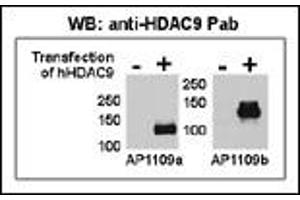 Both anti-HDAC9 N-term ((ABIN387960 and ABIN2844679)) and C-term ((ABIN387961 and ABIN2844680)) Pab were tested by WB and IP-WB using HeLa and HeLa-HDAC9 transfected cells.