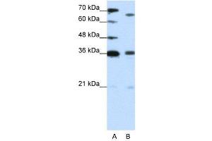 WB Suggested Anti-PRDM13  Antibody Titration: 1. (PRDM13 anticorps  (C-Term))