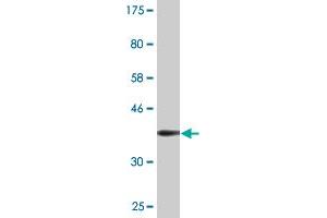 Western Blot detection against Immunogen (36. (PHOSPHO1 anticorps  (AA 168-266))
