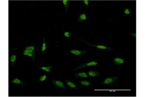 Immunofluorescence of monoclonal antibody to EIF4EBP3 on HeLa cell.