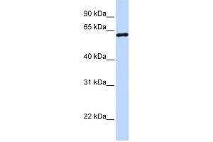 WB Suggested Anti-CSTF2 Antibody Titration:  0. (CSTF2 anticorps  (N-Term))