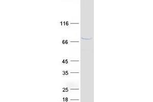 Validation with Western Blot