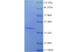 SDS-PAGE (SDS) image for Aquaporin 1 (Colton Blood Group) (AQP1) (AA 220-269), (partial) protein (His-SUMO Tag) (ABIN5709071)