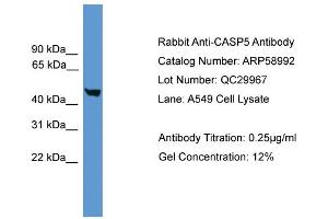 WB Suggested Anti-CASP5  Antibody Titration: 0. (CASP5 anticorps  (Middle Region))